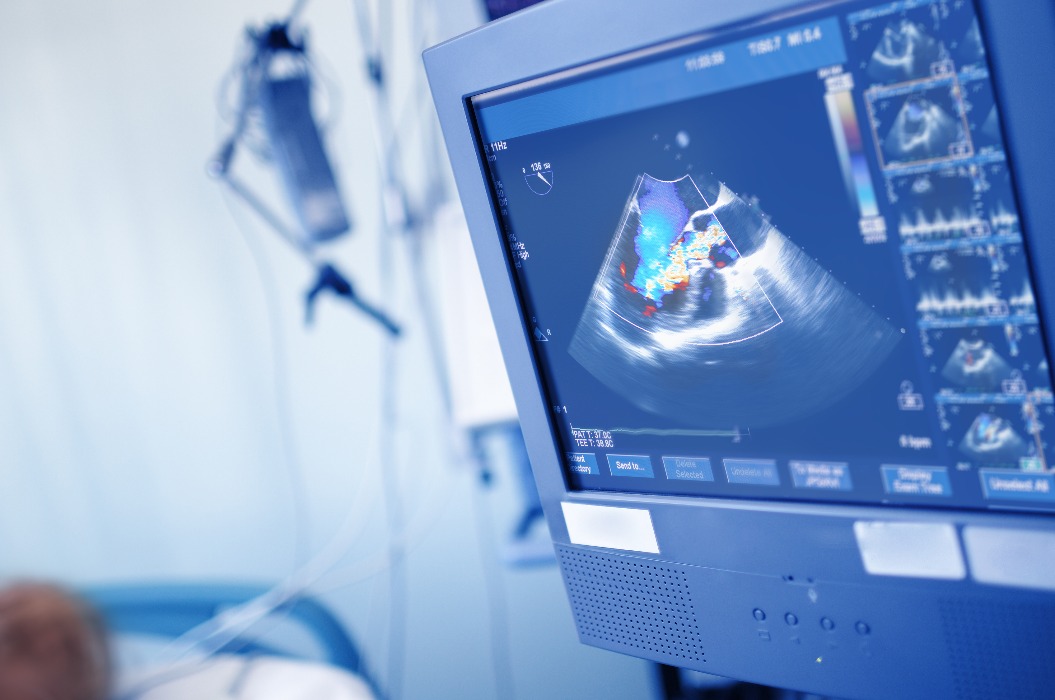 Aufnahme eines Bildschirms während EchoCG-Untersuchung eines Patienten .